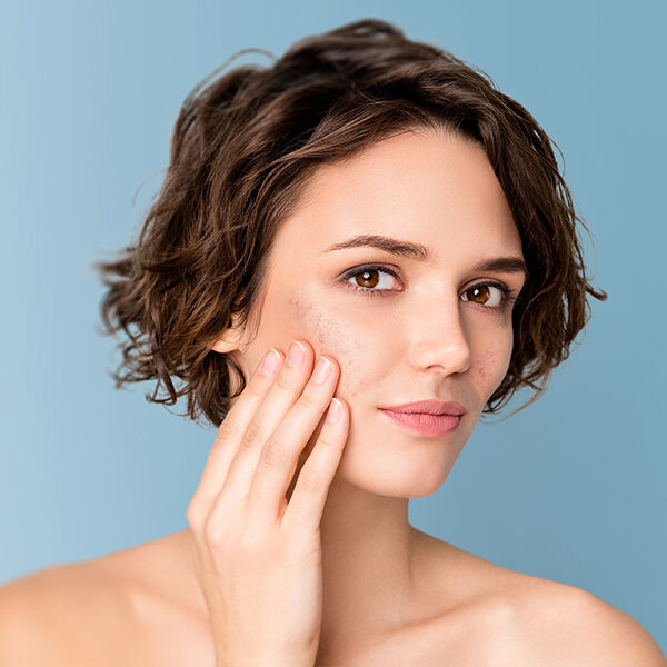 THE 5 SIGNS OF SKIN SENSITIVITY