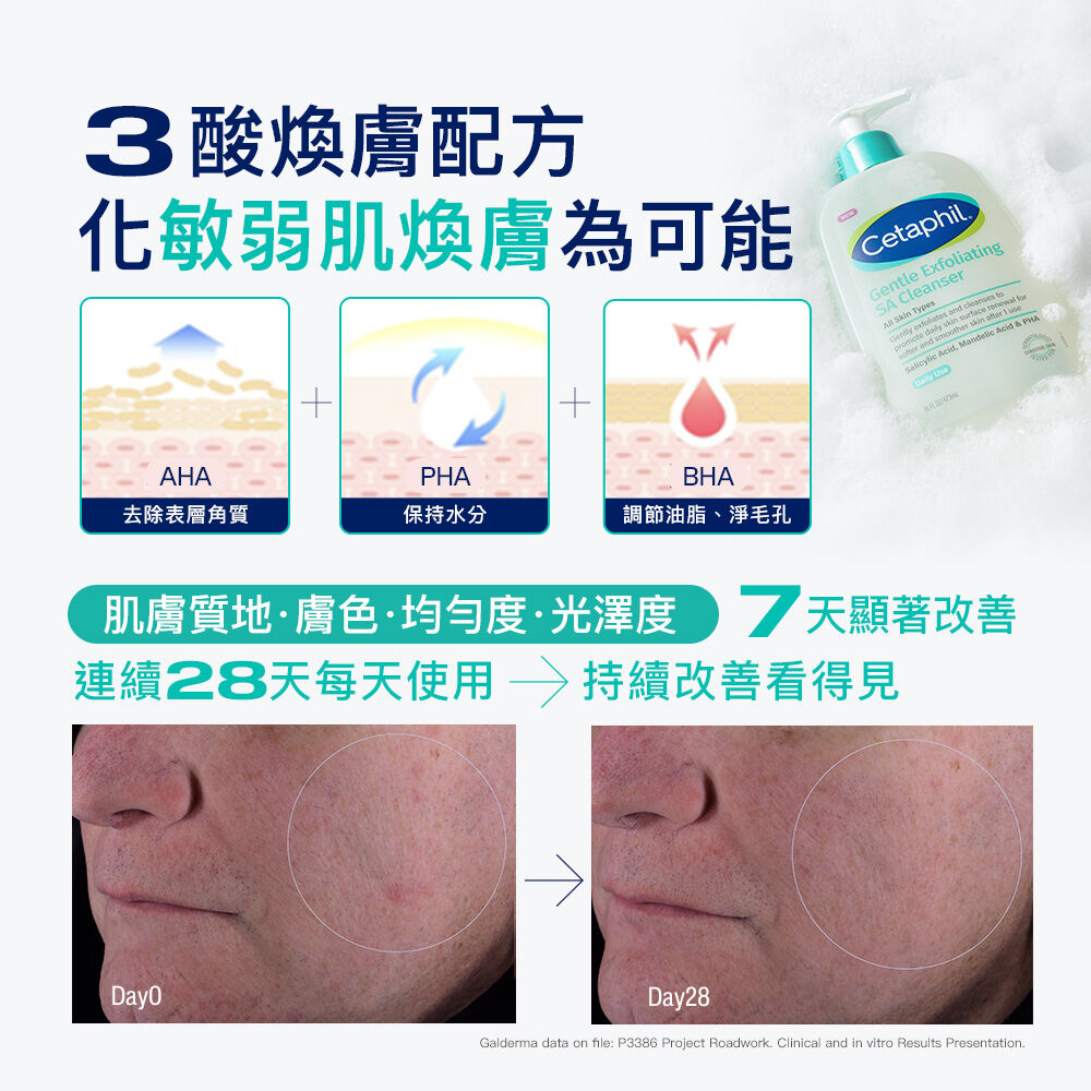 三酸煥膚嫩亮潔膚露