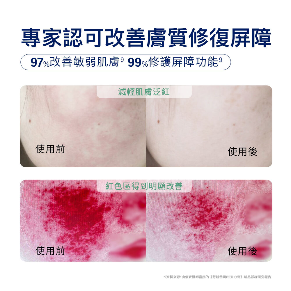 舒新雪潤B5安心霜