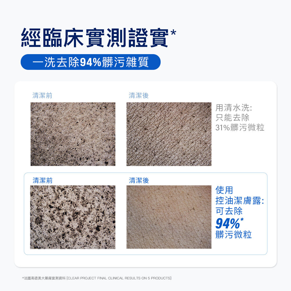 控油潔膚露